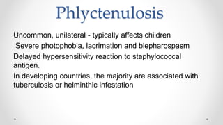Phlyctenulosis
Uncommon, unilateral - typically affects children
Severe photophobia, lacrimation and blepharospasm
Delayed hypersensitivity reaction to staphylococcal
antigen.
In developing countries, the majority are associated with
tuberculosis or helminthic infestation
 