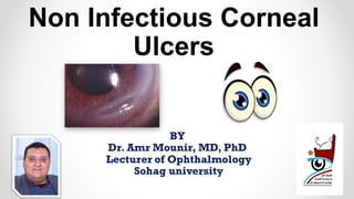 Non Infectious Corneal
Ulcers
 