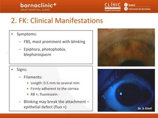 2. FK: Clinical Manifestations
• Symptoms:
   – FBS, most prominent with blinking
   – Epiphora, photophobia,
     blepharospasm


• Signs:
   – Filaments:
       • Length: 0.5 mm to several mm
       • Firmly adherent to the cornea
       • RB +; fluorescein -
   – Blinking may break the attachment –
     epithelial defect (fluo +)            Dr. JL Güell
 