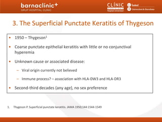 3. The Superficial Punctate Keratitis of Thygeson
 • 1950 – Thygeson1

 • Coarse punctate epithelial keratitis with little or no conjunctival
   hyperemia

 • Unknown cause or associated disease:
       – Viral origin currently not believed

       – Immune process? – association with HLA-DW3 and HLA-DR3

 • Second-third decades (any age), no sex preference



1.   Thygeson P. Superficial punctate keratitis. JAMA 1950;144:1544-1549
 
