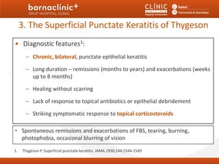3. The Superficial Punctate Keratitis of Thygeson
• Diagnostic features1:
       – Chronic, bilateral, punctate epithelial keratitis

       – Long duration – remissions (months to years) and exacerbations (weeks
         up to 8 months)

       – Healing without scarring

       – Lack of response to topical antibiotics or epithelial debridement

       – Striking symptomatic response to topical corticosteroids

• Spontaneous remissions and exacerbations of FBS, tearing, burning,
  photophobia, occasional blurring of vision

1.    Thygeson P. Superficial punctate keratitis. JAMA 1950;144:1544-1549
 