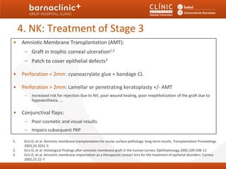 4. NK: Treatment of Stage 3
•    Amniotic Membrane Transplantation (AMT):
      – Graft in trophic corneal ulceration1,2
      – Patch to cover epithelial defects3

•    Perforation < 2mm: cyanoacrylate glue + bandage CL

•    Perforation > 2mm: Lamellar or penetrating keratoplasty +/- AMT
      –   Increased risk for rejection due to NV, poor wound healing, poor reepithelization of the graft due to
          hypoaesthesia, …

•    Conjunctival flaps:
      – Poor cosmetic and visual results
      – Impairs subsequent PKP

1.    Gris O, et al. Amniotic membrane transplantation for ocular surface pathology: long-term results. Transplantation Proceedings
      2003;35:2031-5
2.    Gris O, et al. Histological findings after amniotic membrane graft in the human cornea. Ophthalmoogy 2002;109:508-12
3.    Gris O, et al. Amniotic membrane implantation as a therapeutic contact lens for the treatment of epihelial disorders. Cornea
      2002;21:22-7
 