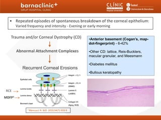 • Repeated episodes of spontaneous breakdown of the corneal epithelium:
         1. Recurrent Erosion Syndromes
        Varied frequency and intensity - Evening or early morning

   Trauma and/or Corneal Dystrophy (CD)                •Anterior basement (Cogan’s, map-
                                                       dot-fingerprint) - 6-42%

        Abnormal Attachment Complexes                  •Other CD: lattice, Reis-Bucklers,
                                                       macular granular, and Meesmann

                                                       •Diabetes mellitus
            Recurrent Corneal Erosions
                                                       •Bullous keratopathy




RCE
MDFP1


               1 Mencucci   R. BJO. 2010;94(7):933-9
 