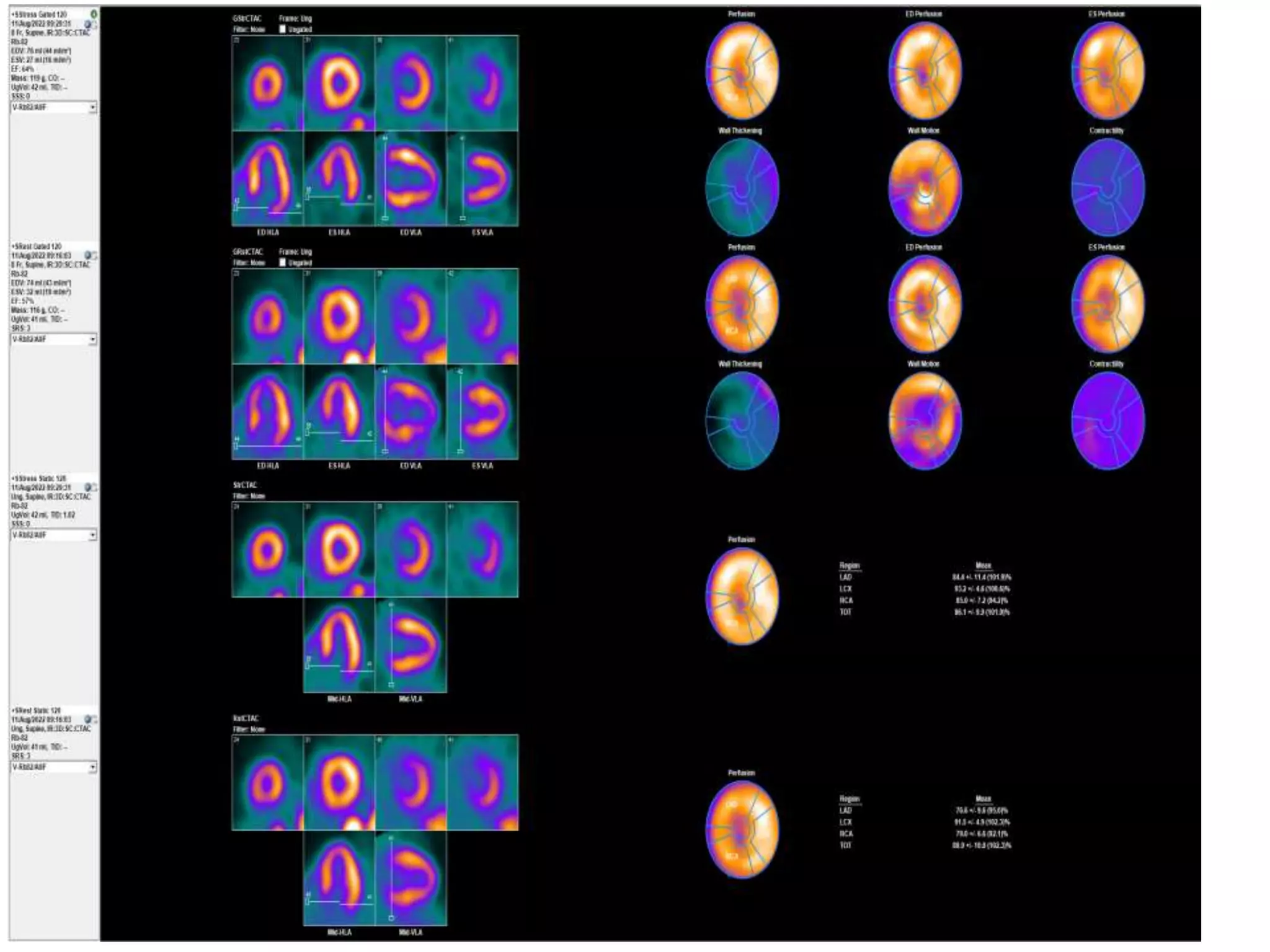 Non Invasive testing of myocardial ischemia AA.pptx