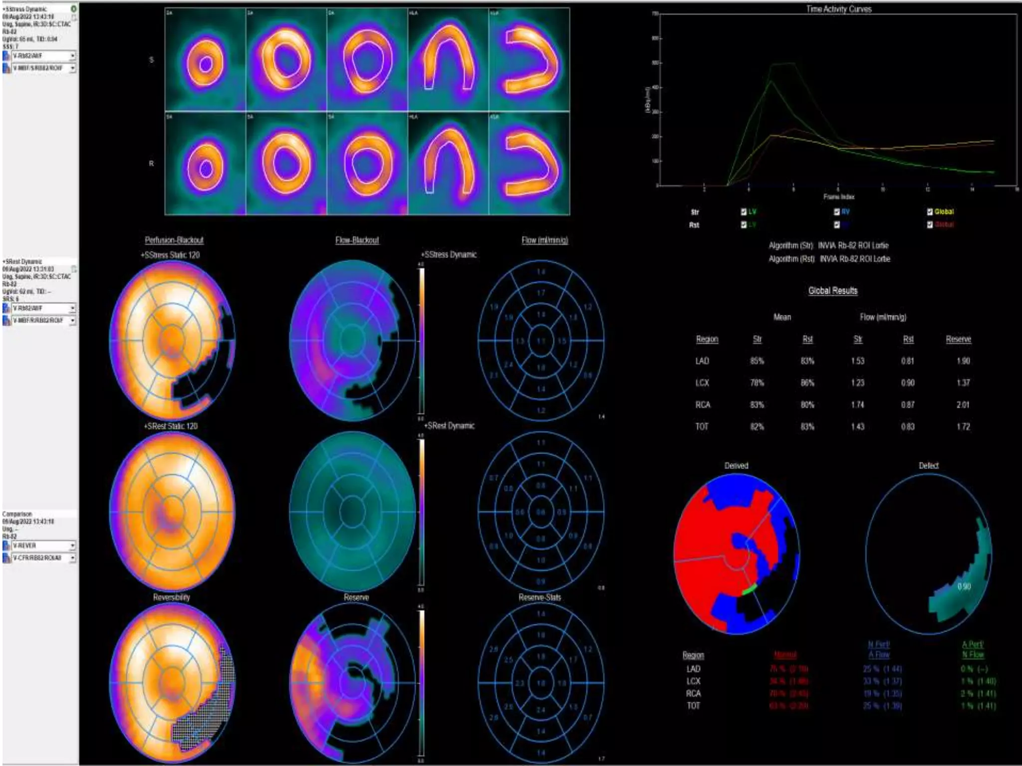 Non Invasive testing of myocardial ischemia AA.pptx