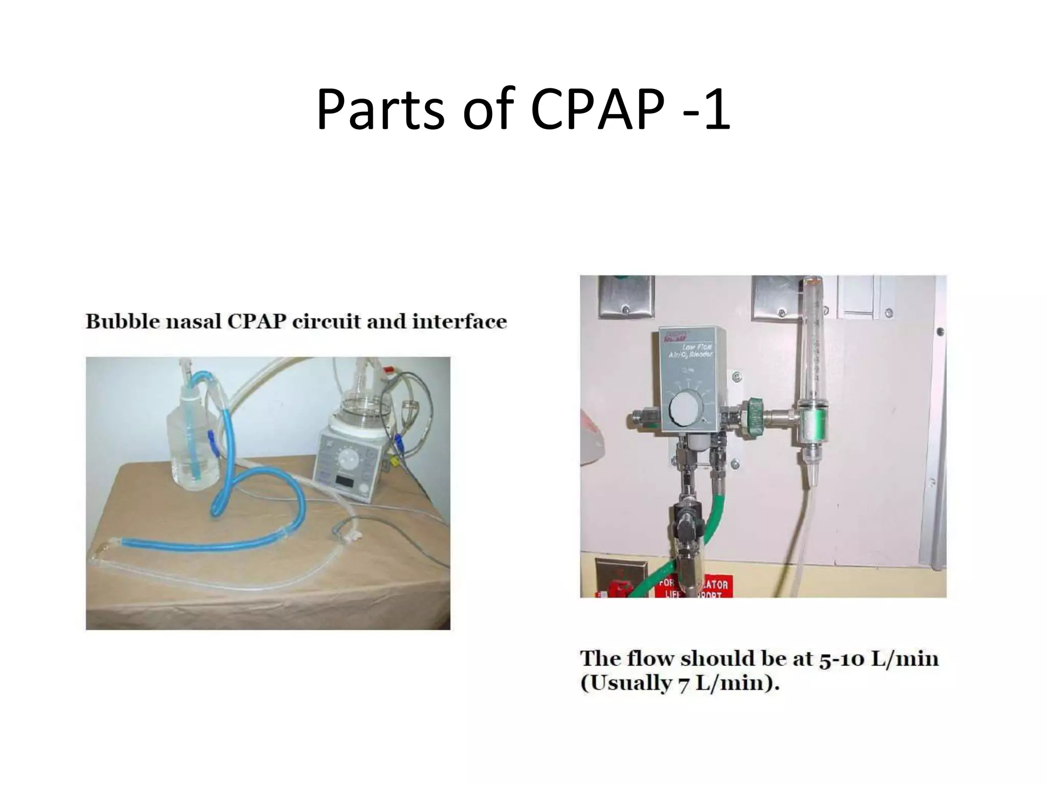 Non invasive ventilation.pdf