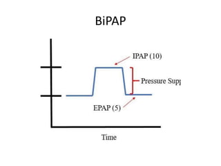 Non invasive ventilations | PPT