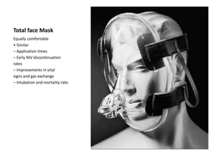 Total face Mask
Equally comfortable
• Similar
– Application times
– Early NIV discontinuation
rates
– Improvements in vital
signs and gas exchange
– Intubation and mortality rate.
 