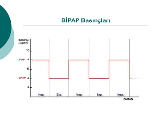 BİPAP Basınçları
 