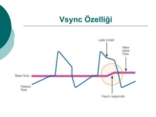 Vsync Özelliği
 