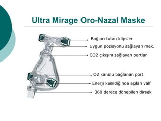 Ultra Mirage Oro-Nazal Maske
Bağları tutan klipsler
Uygun pozisyonu sağlayan mek.
CO2 çıkışını sağlayan portlar
O2 kanülü bağlanan port
Enerji kesildiğinde açılan valf
360 derece dönebilen dirsek
 