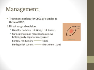 nonmelanocytic skin tumors presentation. | PPT