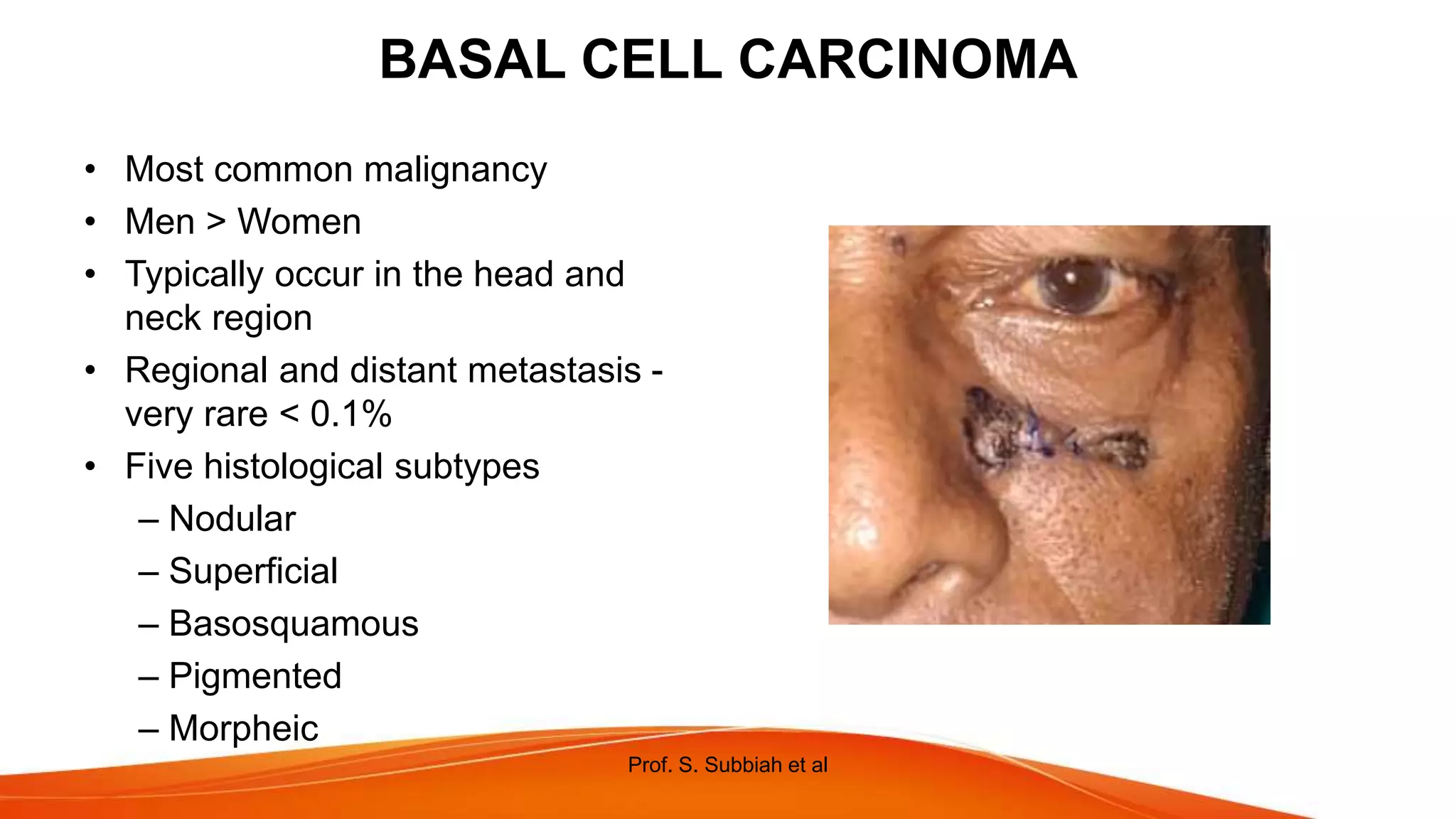 NON MELANOMA SKIN CANCERS IN HEAD AND NECK.pptx