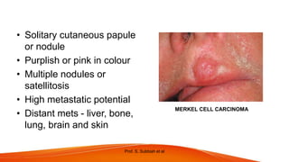 NON MELANOMA SKIN CANCERS IN HEAD AND NECK.pptx
