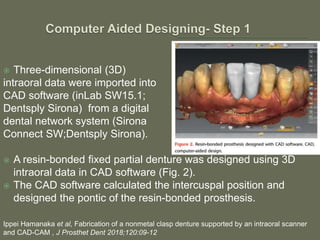 Non-metal clasp removable partial dentures using CAD CAM | PPTX