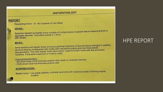 NON MUSCLE INVASIVE BLADDER CANCER 2.pptx