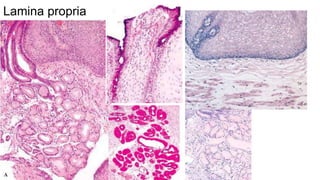 Non neoplastic disorders of esophagus | PPTX