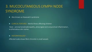 3. MUCOCUTANEOUS LYMPH NODE
SYNDROME
 Also known as Kawasaki’s syndrome
 CLINICAL FEATURES : febrile illness affecting children
fever , cervical lymphadenopathy ,pharyngeal and conjunctival inflammation ,
erythematous skin rashes .
 HISTOPATHOLOGY :
Affected node shows fibrin thrombi in small vessels
 