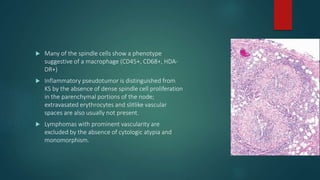  Many of the spindle cells show a phenotype
suggestive of a macrophage (CD45+, CD68+, HDA-
DR+)
 Inflammatory pseudotumor is distinguished from
KS by the absence of dense spindle cell proliferation
in the parenchymal portions of the node;
extravasated erythrocytes and slitlike vascular
spaces are also usually not present.
 Lymphomas with prominent vascularity are
excluded by the absence of cytologic atypia and
monomorphism.
 