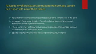 Palisaded Myofibroblastoma (Intranodal Hemorrhagic Spindle
Cell Tumor with Amianthoid Fibers)
 Palisaded myofibroblastoma arises almost exclusively in lymph nodes in the groin
 composed of interlacing fascicles of spindle cells that surround large mats of
eosinophilic material (amianthoid fibers).
 These tumors may be highly vascularized, with associated hemorrhagic foci, and
compress adjacent node parenchyma.
 Spindle cells show focal nuclear palisading mimicking neurilemoma.
 