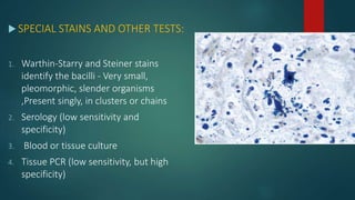  SPECIAL STAINS AND OTHER TESTS:
1. Warthin-Starry and Steiner stains
identify the bacilli - Very small,
pleomorphic, slender organisms
,Present singly, in clusters or chains
2. Serology (low sensitivity and
specificity)
3. Blood or tissue culture
4. Tissue PCR (low sensitivity, but high
specificity)
 