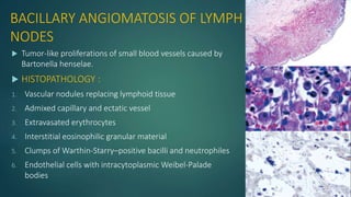 BACILLARY ANGIOMATOSIS OF LYMPH
NODES
 Tumor-like proliferations of small blood vessels caused by
Bartonella henselae.
 HISTOPATHOLOGY :
1. Vascular nodules replacing lymphoid tissue
2. Admixed capillary and ectatic vessel
3. Extravasated erythrocytes
4. Interstitial eosinophilic granular material
5. Clumps of Warthin-Starry–positive bacilli and neutrophiles
6. Endothelial cells with intracytoplasmic Weibel-Palade
bodies
 