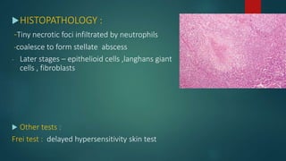 HISTOPATHOLOGY :
-Tiny necrotic foci infiltrated by neutrophils
-coalesce to form stellate abscess
- Later stages – epithelioid cells ,langhans giant
cells , fibroblasts
 Other tests :
Frei test : delayed hypersensitivity skin test
 
