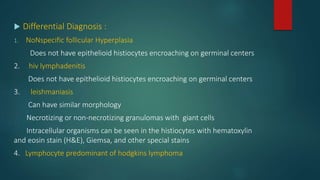  Differential Diagnosis :
1. NoNspecific follicular Hyperplasia
Does not have epithelioid histiocytes encroaching on germinal centers
2. hiv lymphadenitis
Does not have epithelioid histiocytes encroaching on germinal centers
3. leishmaniasis
Can have similar morphology
Necrotizing or non-necrotizing granulomas with giant cells
Intracellular organisms can be seen in the histiocytes with hematoxylin
and eosin stain (H&E), Giemsa, and other special stains
4. Lymphocyte predominant of hodgkins lymphoma
 