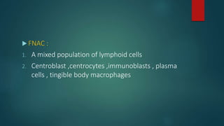  FNAC :
1. A mixed population of lymphoid cells
2. Centroblast ,centrocytes ,immunoblasts , plasma
cells , tingible body macrophages
 