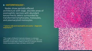  HISTOPATHOLOGY :
Nodes show partially effaced
architecture with large, discrete areas of
eosinophilic necrosis with abundant
karyorrhectic debris surrounded by
transformed lymphocytes, histiocytes,
and plasmacytoid monocytes.
* plasma cells and neutrophils are scanty – diagnostic
importance *
*The origin of Kikuchi-Fujimoto disease is unknown.
Although viruses such as human herpesvirus 6, EBV, and
hepatitis B have been linked to Kikuchi-Fujimoto disease,
these associations have not been confirmed*
 