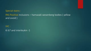 Special stains :
PAS Positive inclusions – hamazaki wesenberg bodies ( yellow
and ovoid )
IHC :
Ki 67 and interleukin -1
 
