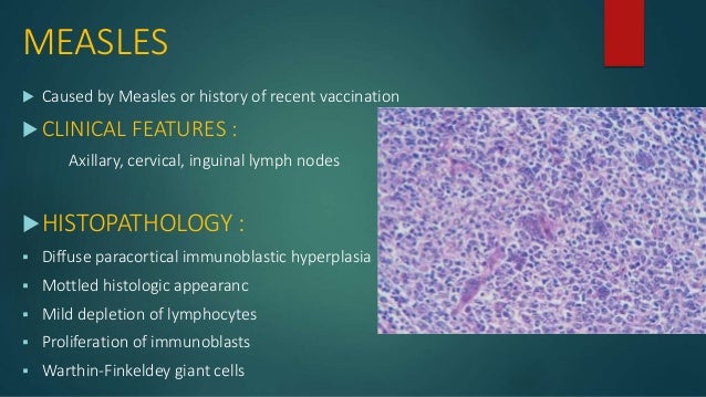 Non neoplastic lymphadenopathy