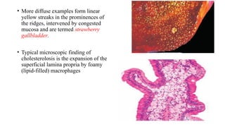non_neoplatic_and_neoplatic_lesions_of_gall bladder Prerna.pptx