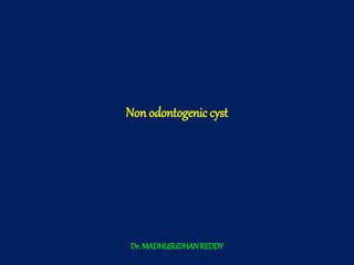 Non odontogenic cyst
Dr. MADHUSUDHANREDDY
 