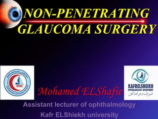NON-PENETRATING
GLAUCOMA SURGERY
Mohamed ELShafie
Assistant lecturer of ophthalmology
Kafr ELShiekh university
 