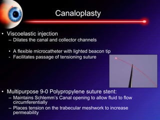 Canaloplasty
• Viscoelastic injection
– Dilates the canal and collector channels
• A flexible microcatheter with lighted beacon tip
- Facilitates passage of tensioning suture
• Multipurpose 9-0 Polypropylene suture stent:
– Maintains Schlemm’s Canal opening to allow fluid to flow
circumferentially
– Places tension on the trabecular meshwork to increase
permeability
 