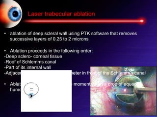 Laser trabecular ablation
• ablation of deep scleral wall using PTK software that removes
successive layers of 0.25 to 2 microns
• Ablation proceeds in the following order:
-Deep sclero- corneal tissue
-Roof of Schlemms canal
-Part of its internal wall
-Adjacent corneal stroma 1 millimeter in front of the Schlemm’s canal
• Ablation is continued up to the moment when a drop of aqueous
humor appears
 
