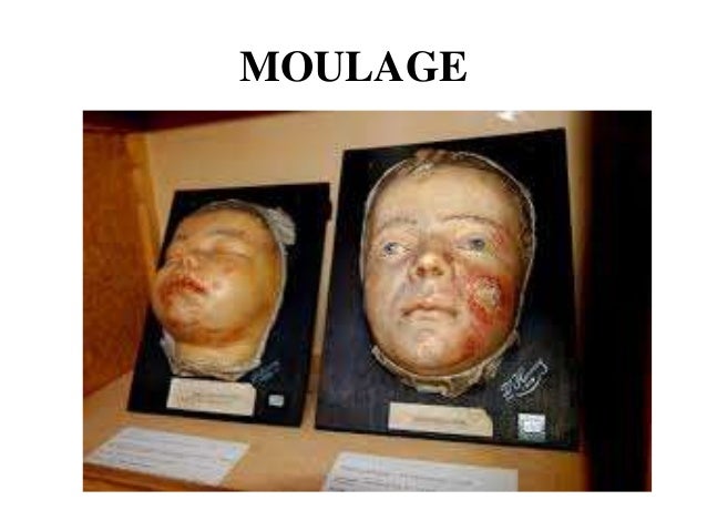 Non projected aids Non projected aids