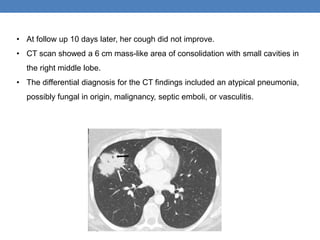 • At follow up 10 days later, her cough did not improve.
• CT scan showed a 6 cm mass-like area of consolidation with small cavities in
the right middle lobe.
• The differential diagnosis for the CT findings included an atypical pneumonia,
possibly fungal in origin, malignancy, septic emboli, or vasculitis.
 