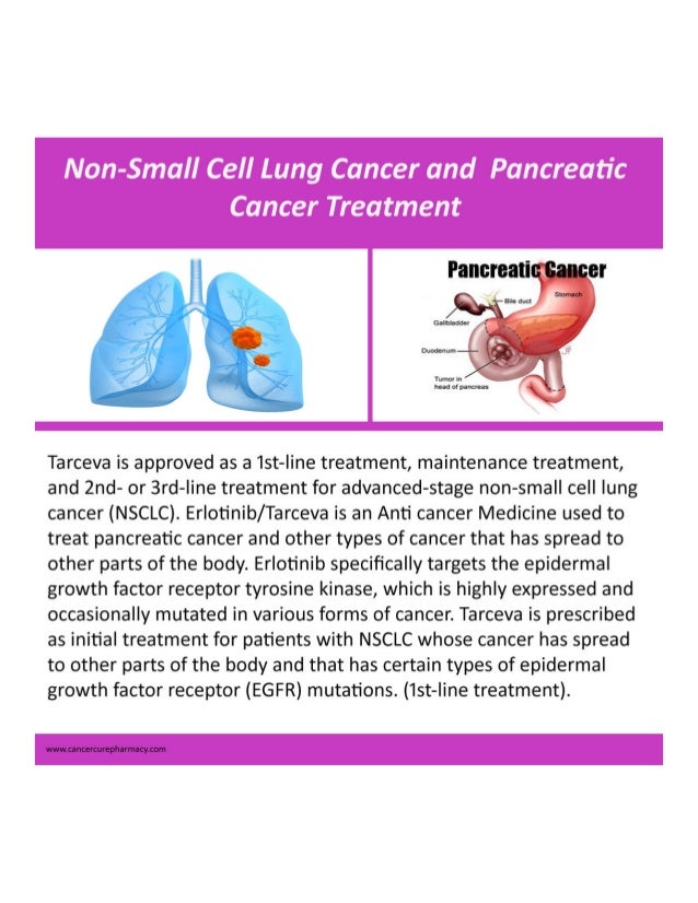 Chemo for small cell lung cancer