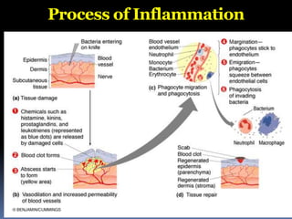 Process of Inflammation
 