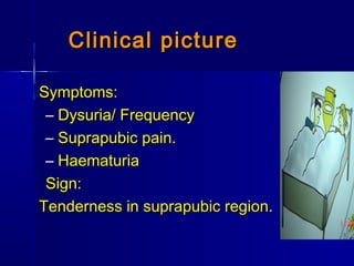 Clinical pictureClinical picture
Symptoms:Symptoms:
– Dysuria/ FrequencyDysuria/ Frequency
– Suprapubic pain.Suprapubic pain.
– HaematuriaHaematuria
Sign:Sign:
Tenderness in suprapubic region.Tenderness in suprapubic region.
 