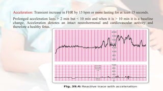 Reactive Non Stress Test