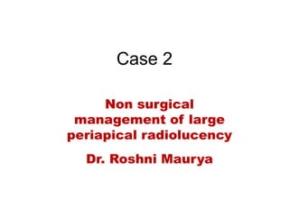 Case 2
Non surgical
management of large
periapical radiolucency
Dr. Roshni Maurya
 
