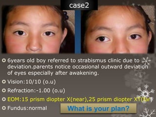 Refractive Strabismus Non surgical management of strabismus .ppt