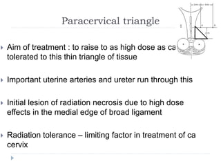 Paracervical triangle
 Aim of treatment : to raise to as high dose as can be
tolerated to this thin triangle of tissue
 Important uterine arteries and ureter run through this
 Initial lesion of radiation necrosis due to high dose
effects in the medial edge of broad ligament
 Radiation tolerance – limiting factor in treatment of ca
cervix
 
