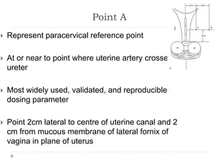Point A
 Represent paracervical reference point
 At or near to point where uterine artery crosses
ureter
 Most widely used, validated, and reproducible
dosing parameter
 Point 2cm lateral to centre of uterine canal and 2
cm from mucous membrane of lateral fornix of
vagina in plane of uterus
 