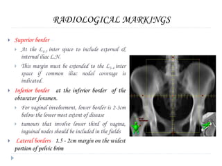 RADIOLOGICAL MARKINGS
 Superior border –
 At the L4-5 inter space to include external &
internal iliac L.N.
 This margin must be extended to the L3-4 inter
space if common iliac nodal coverage is
indicated.
 Inferior border - at the inferior border of the
obturator foramen.
 For vaginal involvement, lower border is 2-3cm
below the lower most extent of disease
 tumours that involve lower third of vagina,
inguinal nodes should be included in the fields
 Lateral borders - 1.5 - 2cm margin on the widest
portion of pelvic brim
 