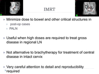 IMRT
 Minimize dose to bowel and other critical structures in
 post-op cases
 PALN
 Useful when high doses are required to treat gross
disease in regional LN
 Not alternative to brachytherapy for treatment of central
disease in intact cervix
 Very careful attention to detail and reproducibility
required
 