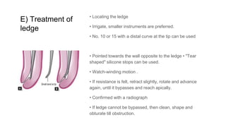 Ledge Radiograph Nonsurgical retreatment in endodontics by Dr. Khirabdhi T Mishra | PPTX